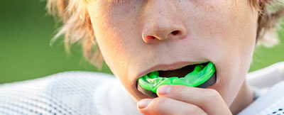 sports-mouthguard-birmingham-al