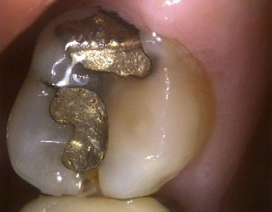 molars-2-birmingham-al-